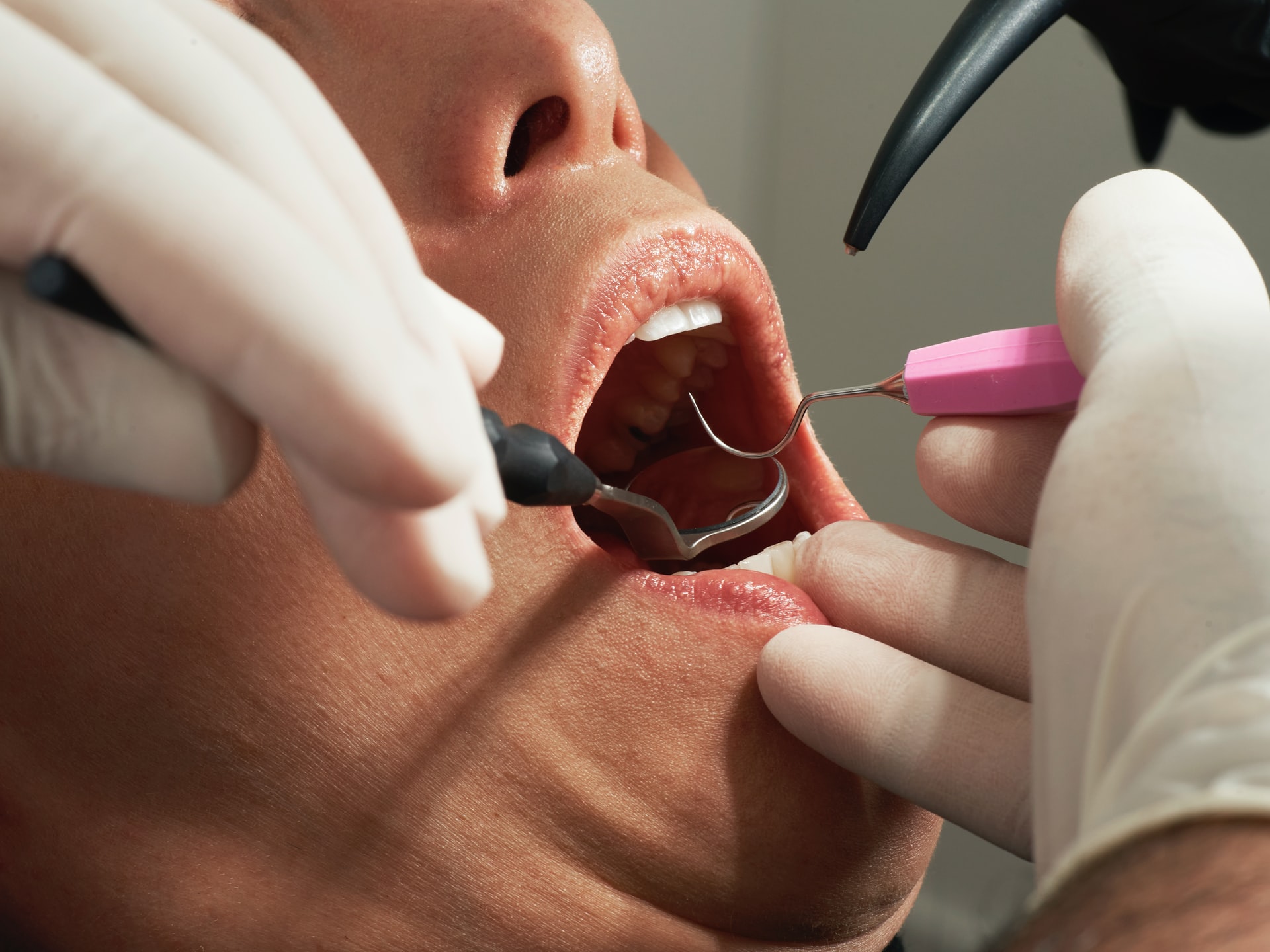 Our Guide To The Different Types Of Dental Surgery